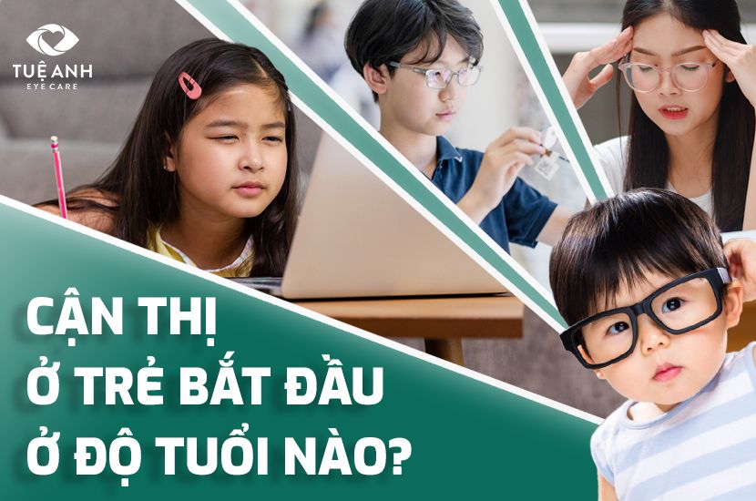 CẬN THỊ Ở TRẺ BẮT ĐẦU Ở ĐỘ TUỔI NÀO?