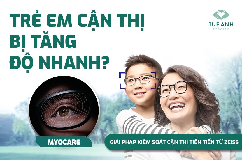 TRẺ CẬN THỊ TĂNG NHANH? CÔNG NGHỆ ZEISS MYOCARE GIÚP LÀM CHẬM TIẾN TRÌNH CẬN THỊ AN TOÀN & HIỆU QUẢ