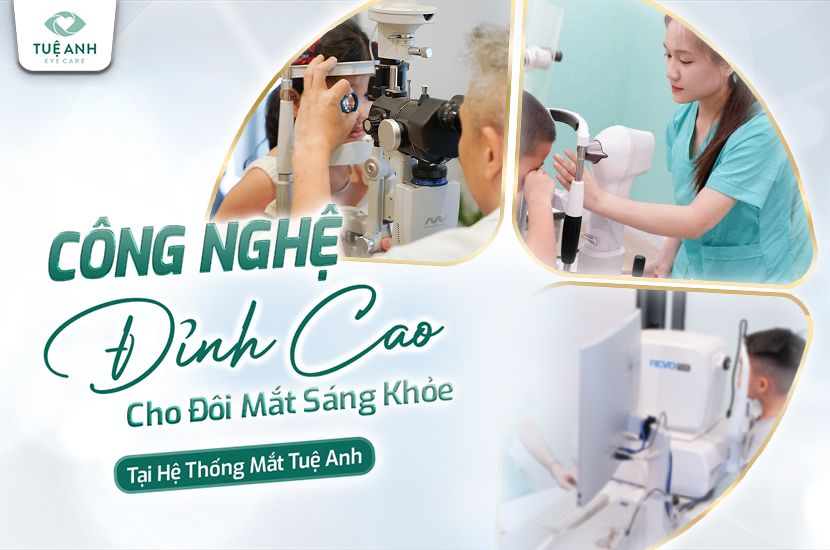 Công nghệ đỉnh cao – Hỗ trợ kiểm soát cận thị cho trẻ tại Mắt Tuệ Anh