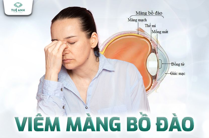 Viêm màng bồ đào: Cách nhận biết, chẩn đoán và điều trị hiệu quả
