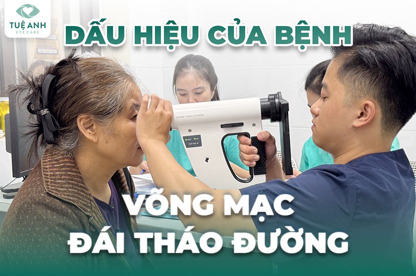 Đừng chủ quan với những thay đổi thị lực – có thể đó là dấu hiệu của bệnh võng mạc đái tháo đường.