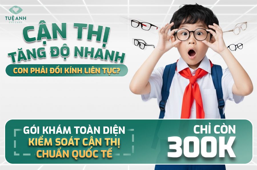 Ưu đãi khám kiểm soát cận thị cho trẻ: chỉ 300.000đ và miễn phí đo trục nhãn cầu
