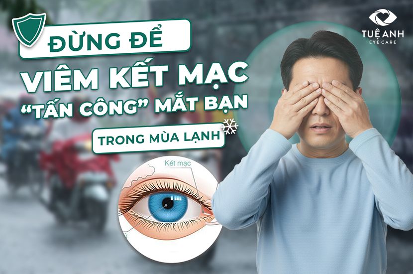 Đừng để viêm kết mạc “tấn công” đôi mắt trong mùa lạnh