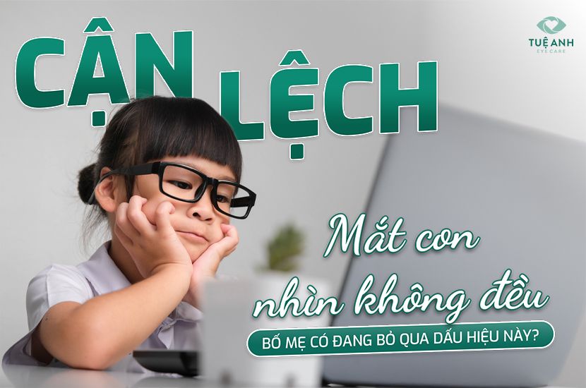 Bố mẹ đã nhận ra điều này về mắt con chưa?