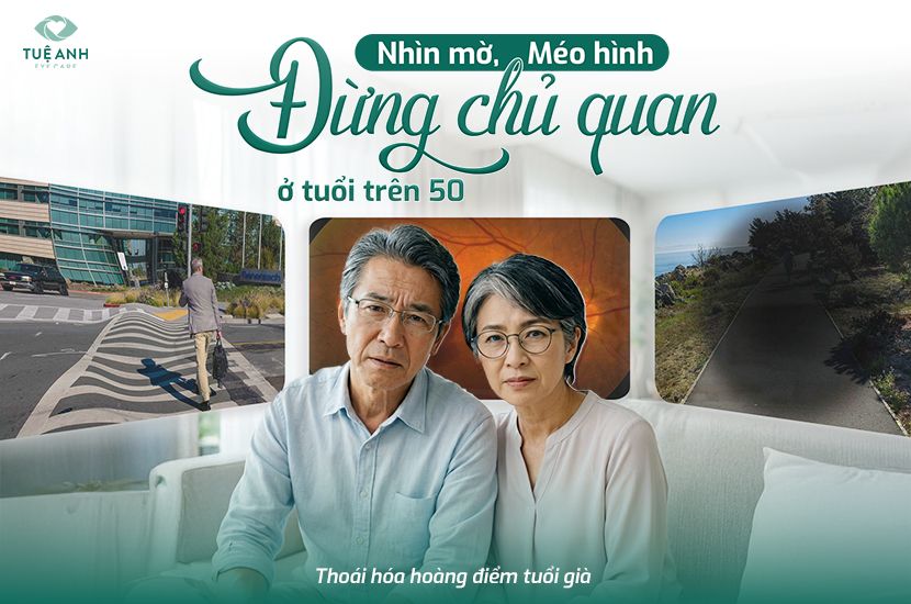 Thoái hóa hoàng điểm – Đừng chủ quan khi nhìn mờ, méo hình sau tuổi 50