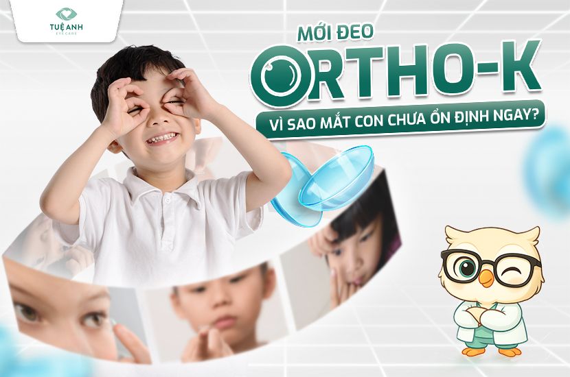 Tại sao mới đeo Ortho-K thị lực chưa ổn định ngay? 
