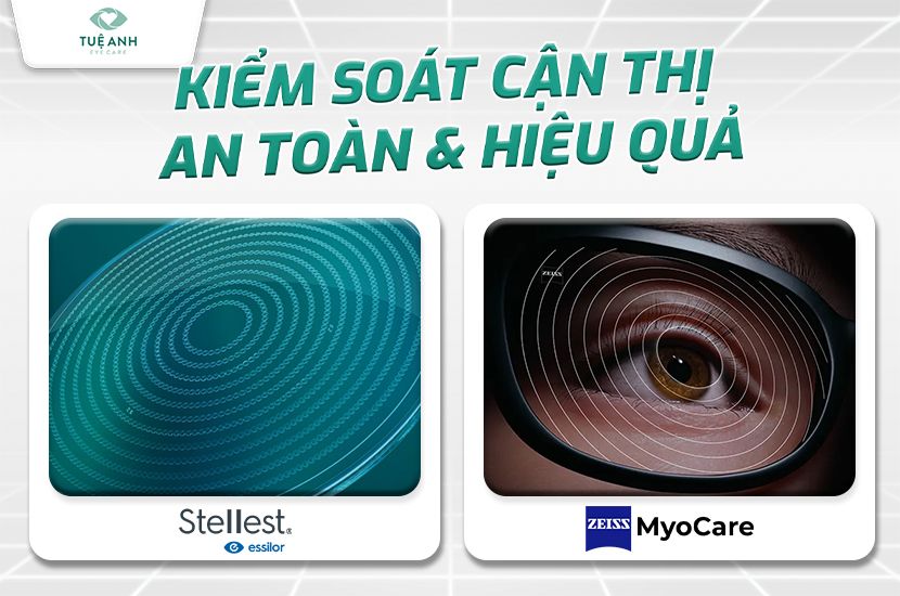 STELLEST & MYOCARE: Giải pháp vàng kiểm soát cận thị cho trẻ em