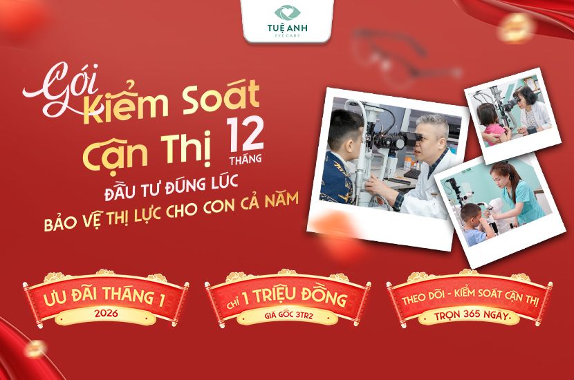 Ưu đãi gói Kiểm soát cận thị 12 tháng chỉ với 1.000.000Đ: An tâm cho con - Tiết kiệm cho mẹ