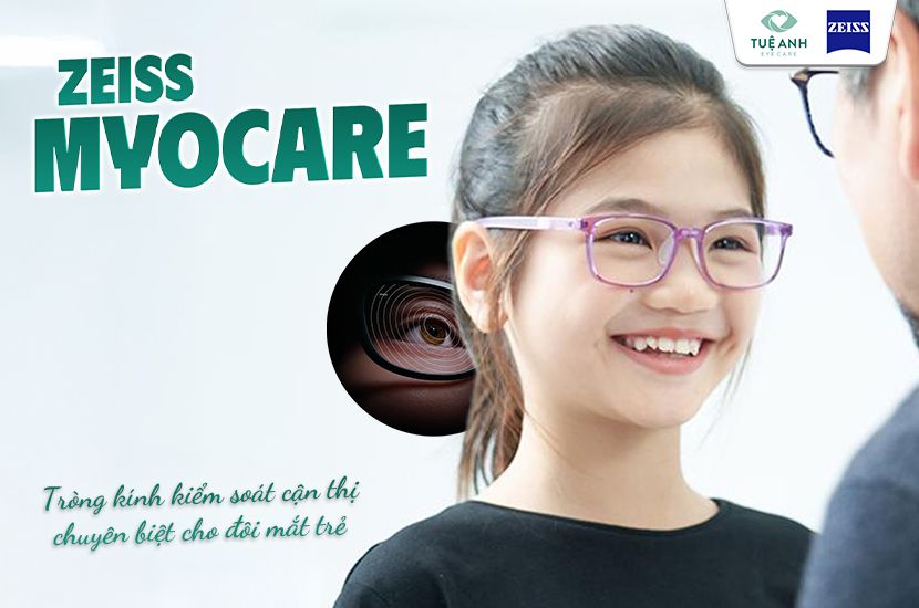 Tròng kính kiểm soát cận thị Myocare: Giải pháp vàng bảo vệ thị lực cho trẻ 