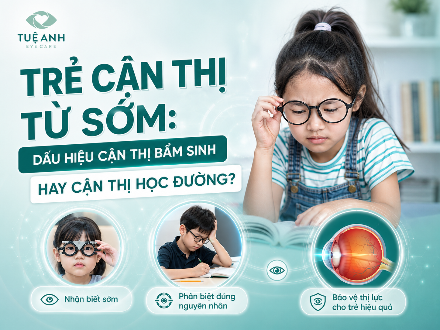 Trẻ cận thị từ sớm: Dấu hiệu cận thị bẩm sinh hay cận thị học đường? 