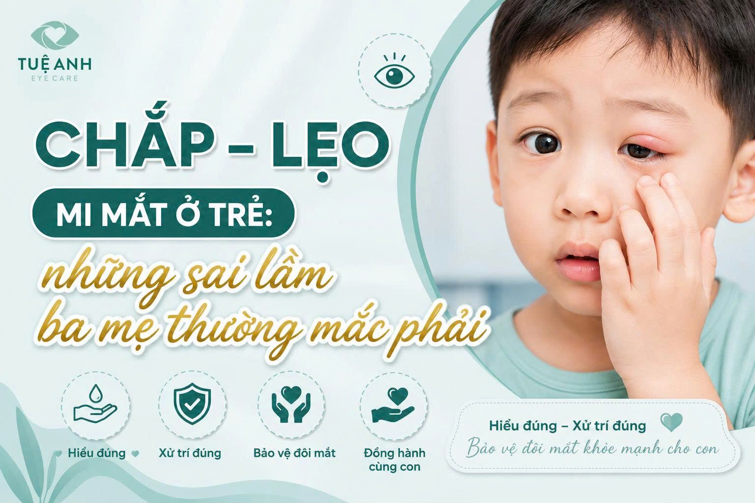 Chắp và lẹo mi mắt ở trẻ: 4 Sai lầm nguy hiểm ba mẹ thường mắc phải 